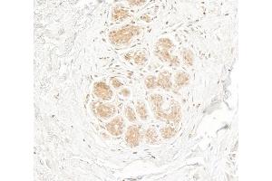 anti-Retinoic Acid Induced 1 (RAI1) (AA 25-75) antibody