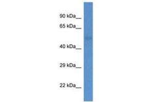Image no. 1 for anti-1-Acylglycerol-3-Phosphate O-Acyltransferase 6 (Lysophosphatidic Acid Acyltransferase, Zeta) (AGPAT6) (AA 209-258) antibody (ABIN6746911) (AGPAT6 抗体  (AA 209-258))