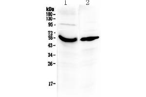 Western blot analysis of Vitamin D Binding protein using anti-Vitamin D Binding protein antibody . (Gc (AA 17-256) 抗体)