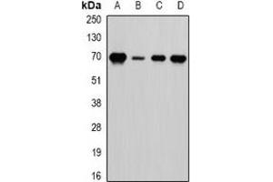 Western blot analysis of LTA4H expression in HepG2 (A), Romas (B), mouse spleen (C), mouse brain (D) whole cell lysates. (LTA4H 抗体)