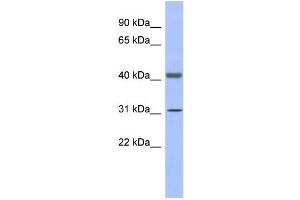 WB Suggested Anti-GAPDHS Antibody Titration:  0. (GAPDHS 抗体  (N-Term))
