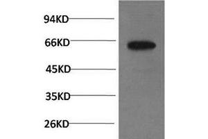 Western Blot analysis of PC-3 cells using Phospho-AKT1 (Ser473) Monoclonal Antibody at dilution of 1:1000 (AKT1 抗体  (pSer473))