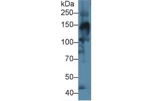 Western Blot; Sample: Mouse Skeletal muscle lysate; Primary Ab: 1µg/ml Rabbit Anti-Human COL4a3 Antibody Second Ab: 0. (COL4a3 抗体  (AA 1428-1670))