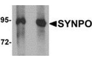 Western blot analysis of SYNPO in Rat brain tissue lysate with SYNPO antibody at (left) 1 and (right) 2 μg/ml. (SYNPO 抗体  (C-Term))