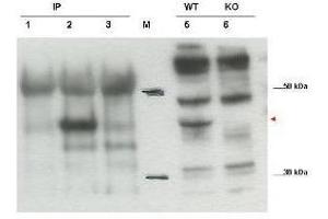 Western blot using  affinity purified anti-Cybr antibody shows detection of endogenous Cybr from mouse splenocytes using anti-Cybr antibody to immunoprecipitate and western blot (lanes 1-3).