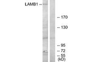 Western blot analysis of extracts from HepG2 cells, using LAMB1 Antibody. (Laminin beta 1 抗体  (AA 1721-1770))