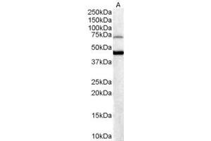 ABIN184820 (0. (FOXG1 抗体  (C-Term))