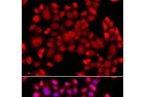 Immunofluorescence analysis of A549 cells using PIP4K2B Polyclonal Antibody (PIP4K2B 抗体)