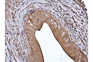 IHC-P Image 14-3-3 beta antibody [N1C2] detects 14-3-3 beta protein at cytoplasm in rat cervix by immunohistochemical analysis. (YWHAB 抗体  (Center))