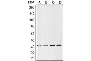 Western blot analysis of CMKLR1 expression in Jurkat (A), HepG2 (B), mouse liver (C), rat liver (D) whole cell lysates. (CMKLR1 抗体  (Center))