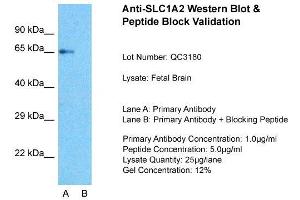 SLC1A2 抗体  (N-Term)