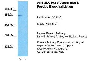 Host:  Rabbit  Target Name:  SLC1A2  Sample Type:  Fetal Brain  Lane A:  Primary Antibody  Lane B:  Primary Antibody + Blocking Peptide  Primary Antibody Concentration:  1ug/ml  Peptide Concentration:  5ug/ml  Lysate Quantity:  25ug/lane/Lane  Gel Concentration:  0. (SLC1A2 抗体  (N-Term))