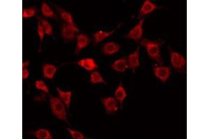 ABIN6272363 staining Hela by IF/ICC. (Nidogen 1 抗体  (Internal Region))