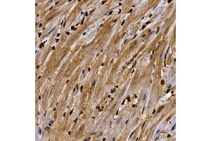 Immunohistochemistry (IHC) image for anti-Aryl Hydrocarbon Receptor (AHR) (AA 619-848) antibody (ABIN5663909)