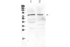 Western blot analysis of CHAT using anti- CHAT antibody . (Choline Acetyltransferase 抗体  (AA 446-652))