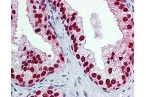 Anti-FOXA1 antibody IHC of human prostate.