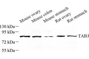 Western blot analysis of tab3 (ABIN7075877) at dilution of 1: 500 (TAB3 抗体)