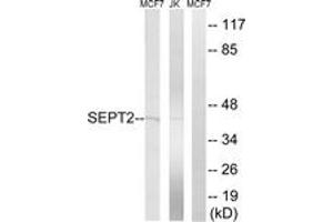 Western blot analysis of extracts from Jurkat/MCF-7 cells, using SEPT2 Antibody. (Septin 2 抗体  (AA 103-152))