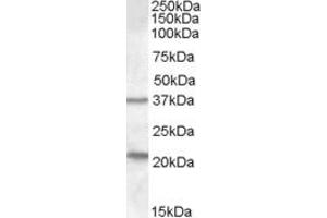 ABIN334520 (1µg/ml) staining of Human Liver lysate (35µg protein in RIPA buffer). (TUSC3 抗体  (Internal Region))