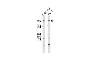 All lanes : Anti-DYNC1H1 Antibody (C-term) at 1:2000 dilution Lane 1: U-87 MG whole cell lysates Lane 2: PC-3 whole cell lysates Lysates/proteins at 20 μg per lane. (DYNC1H1 抗体  (C-Term))