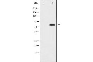 Western blot analysis of FOXO4 expression in K562 whole cell lysates,The lane on the left is treated with the antigen-specific peptide. (FOXO4 抗体  (C-Term))