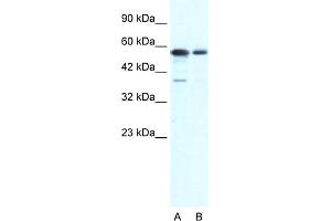 WB Suggested Anti-G22P1 Antibody Titration:  1. (XRCC6 抗体  (N-Term))