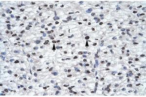 Rabbit Anti-GLI2 Antibody  Paraffin Embedded Tissue: Human Heart Cellular Data: Myocardial cells Antibody Concentration: 4. (GLI2 抗体  (Middle Region))