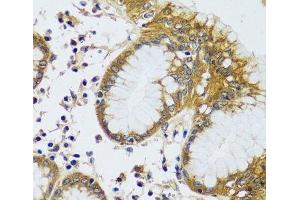Immunohistochemistry (Paraffin-embedded Sections) (IHC (p)) image for anti-Calcium Modulating Ligand (CAMLG) antibody (ABIN7257333)