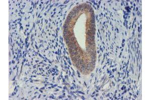 Image no. 1 for anti-Metalloproteinase Inhibitor 2 (TIMP2) antibody (ABIN1501394) (TIMP2 抗体)