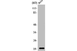 Western Blot analysis of Jurkat cells using SRp20 Polyclonal Antibody (SRSF3 抗体  (C-Term))
