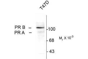 Western Blotting (WB) image for anti-Progesterone Receptor (PGR) (pSer294) antibody (ABIN371835) (Progesterone Receptor 抗体  (pSer294))