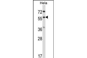 RANG Antibody (N-term) 3776a western blot analysis in Hela cell line lysates (35 μg/lane). (RANGAP1 抗体  (N-Term))