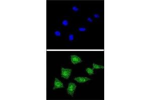 Confocal immunofluorescent analysis of SOD1 antibody with 293 cells followed by Alexa Fluor 488-conjugated goat anti-rabbit lgG (green). (SOD1 抗体  (AA 55-84))