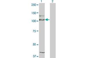 Western Blot analysis of KIT expression in transfected 293T cell line by KIT monoclonal antibody (M04), clone 1G1. (KIT 抗体  (AA 41-140))