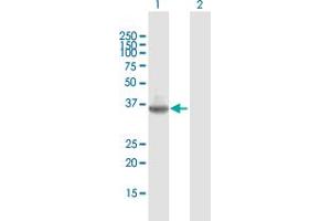 Western Blot analysis of TMIGD2 expression in transfected 293T cell line by TMIGD2 MaxPab polyclonal antibody. (TMIGD2 抗体  (AA 1-282))