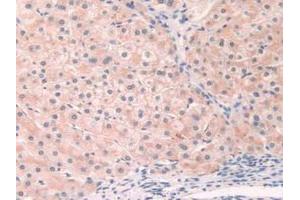 IHC-P analysis of Human Liver Tissue, with DAB staining. (Fibronectin 抗体  (AA 313-607))
