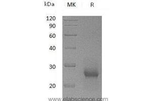 Western Blotting (WB) image for TIMP Metallopeptidase Inhibitor 1 (TIMP1) protein (ABIN7320662) (TIMP1 蛋白)