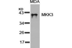 Image no. 3 for anti-Mitogen-Activated Protein Kinase Kinase 3 (MAP2K3) (Ser189) antibody (ABIN197297) (MAP2K3 抗体  (Ser189))