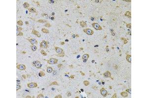 Immunohistochemistry of paraffin-embedded Rat brain using RhoA Polyclonal Antibody at dilution of 1:100 (40x lens). (RHOA 抗体)