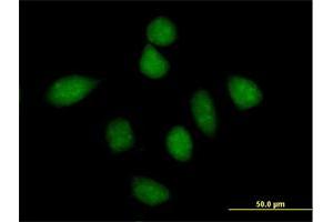 Immunofluorescence (IF) image for anti-Protein Phosphatase 1, Regulatory Subunit 13 Like (PPP1R13L) (AA 1-828) antibody (ABIN524250)