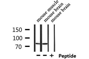 Western blot analysis of extracts from mouse muscle and mouse brain, using USP51 Antibody. (USP51 抗体)