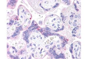 ABCB1 antibody was used for immunohistochemistry at a concentration of 4-8 ug/ml. (ABCB1 抗体)