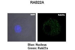 Lanes: Murin JAWS-II cells Primary Antibody Dilution: 1:1000Secondary Antibody: Anti-rabbit-FITC Secondary Antibody Dilution: 1:0500  Gene Name: Blue: Nucleus Green: Rab22a Submitted by: RAB22A (RAB22A 抗体  (Middle Region))