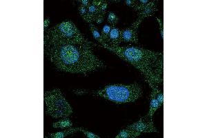 Immunofluorescence (IF) image for anti-Notch 3 (NOTCH3) antibody (ABIN3002554) (NOTCH3 抗体)