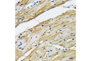 Immunohistochemistry of paraffin-embedded rat heart using GOT1 antibody. (GOT1 抗体  (AA 244-413))