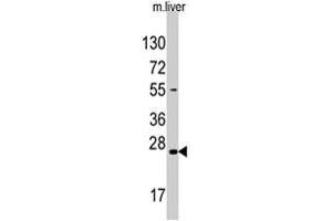 Western blot analysis of SOST polyclonal antibody  in mouse liver tissue lysate (35 ug/lane). (Sclerostin 抗体  (N-Term))