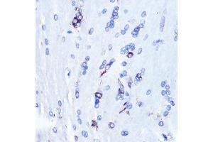 Immunohistochemistry of paraffin-embedded rat brain using YB-1/YBX1 Rabbit mAb (ABIN7271410) at dilution of 1:100 (40x lens). (YBX1 抗体)