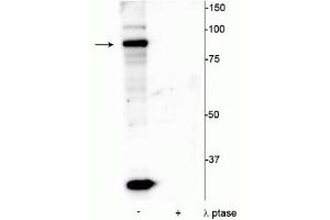 Western blot of mouse testicular lysate showing specific immunolabeling of the ~86 kDa ATRIP protein phosphorylated at Ser239 in the first lane (-). (ATRIP 抗体  (pSer239))