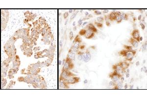 Immunohistochemistry (IHC) image for anti-Isocitrate Dehydrogenase 2 (NADP+), Mitochondrial (IDH2) (AA 402-452) antibody (ABIN7455220) (IDH2 抗体  (AA 402-452))