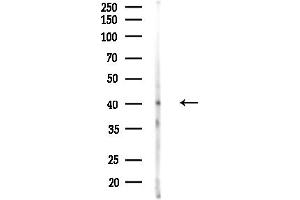anti-Protein Tob1 (TOB1) (Internal Region) antibody